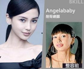 西安整容爆料案件最新情况